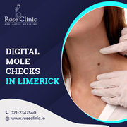 Comprehensive/Full-Body Digital Mole Checks in Limerick-Rose Clinic