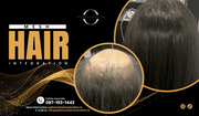 Let’s Revealing The Secret Of Our Mesh Hair Integration Service